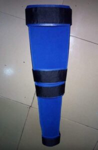 Backslab orthopedic support for injury immobilization
